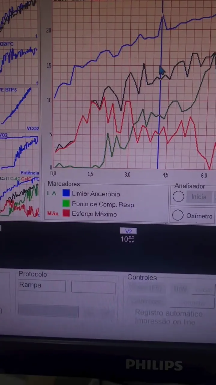 Tela do software de ergoespirometria mostrando o traçado e os marcadores de limiar anaeróbio